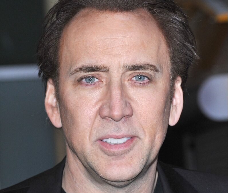 Trapianto capelli Nicolas Cage