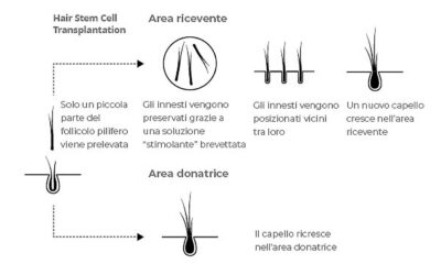 Stem Cells in Hair Transplantation – Hasci Swiss