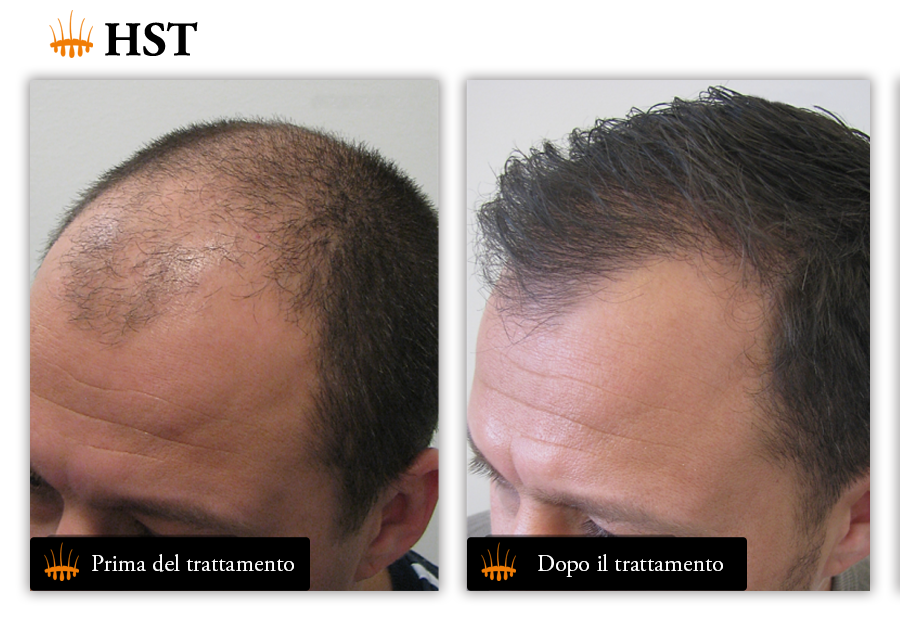 Hair Science Institute di Dr Coen Gho – Hasci Italia