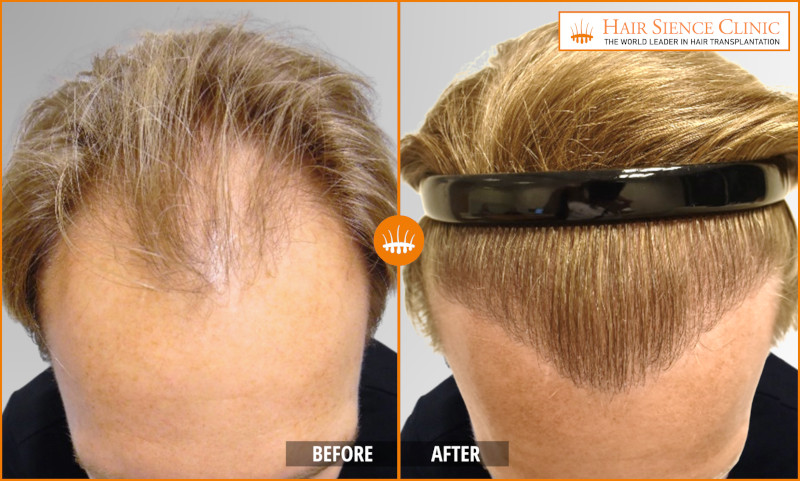 HST Technique: Does It Really Work? Evidence & Results