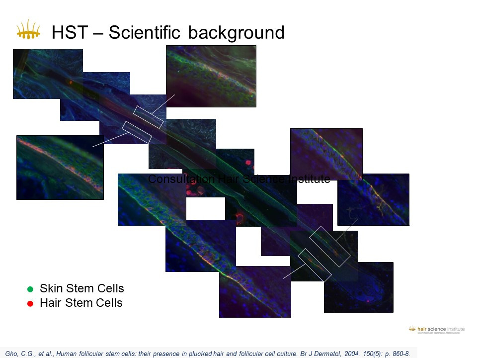 HST - Scientific background