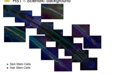 HST and Hair Stem Cells: The Cutting-Edge Science Behind Modern Hair Restoration