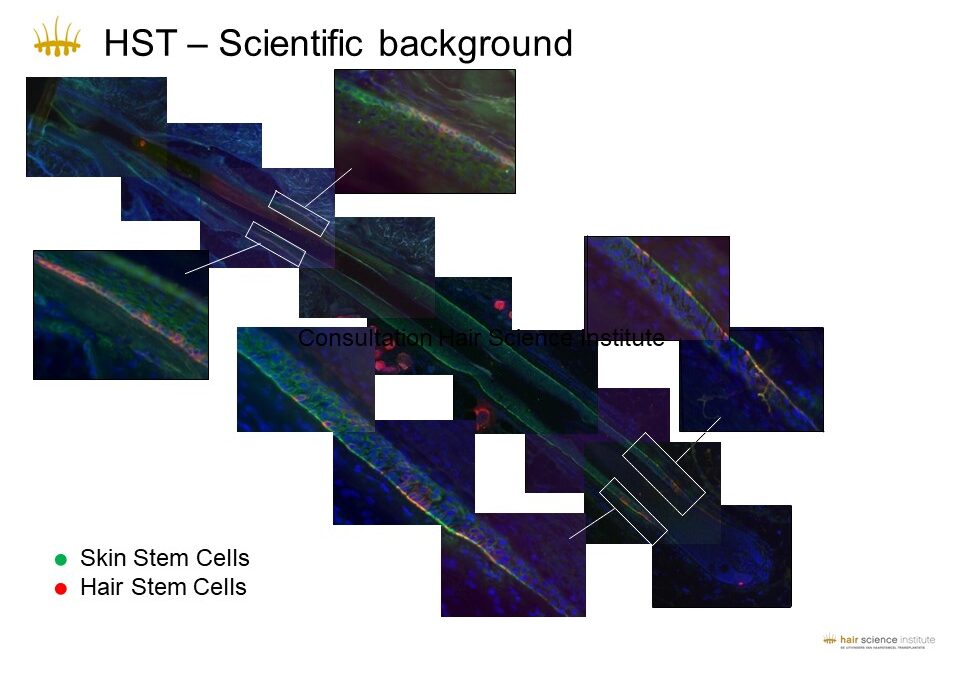 HST e Cellule Staminali Pilifere: La Scienza Dietro il Restauro Capillare del Futuro