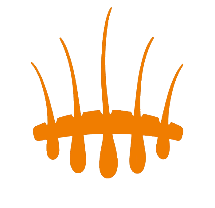 Best hair transplantation in the world – Hasci Swiss