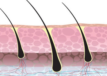 HST Hair: A Game-Changing Development in Hair Restoration